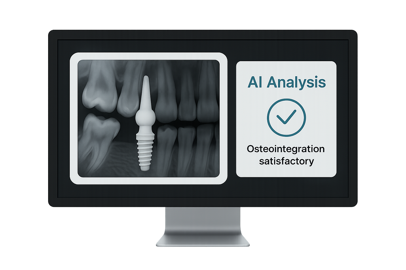 Radiographie analyse IA
